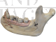Didactic jaw